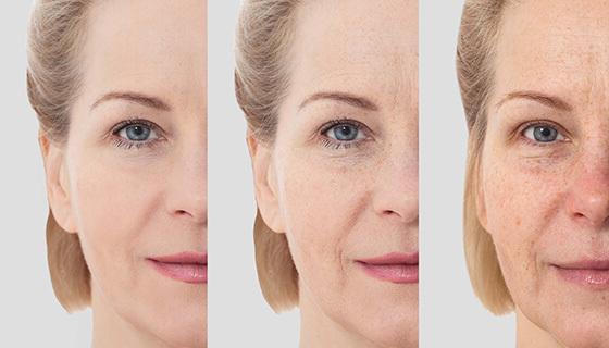 Close-up image of a woman’s face showing before-and-after cosmetic treatment.